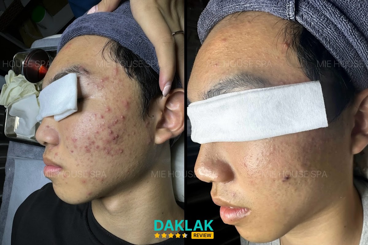 MIE HOUSE SPA ( chuyên chăm sóc da) - chăm sóc da Krông Pắc - hình 3