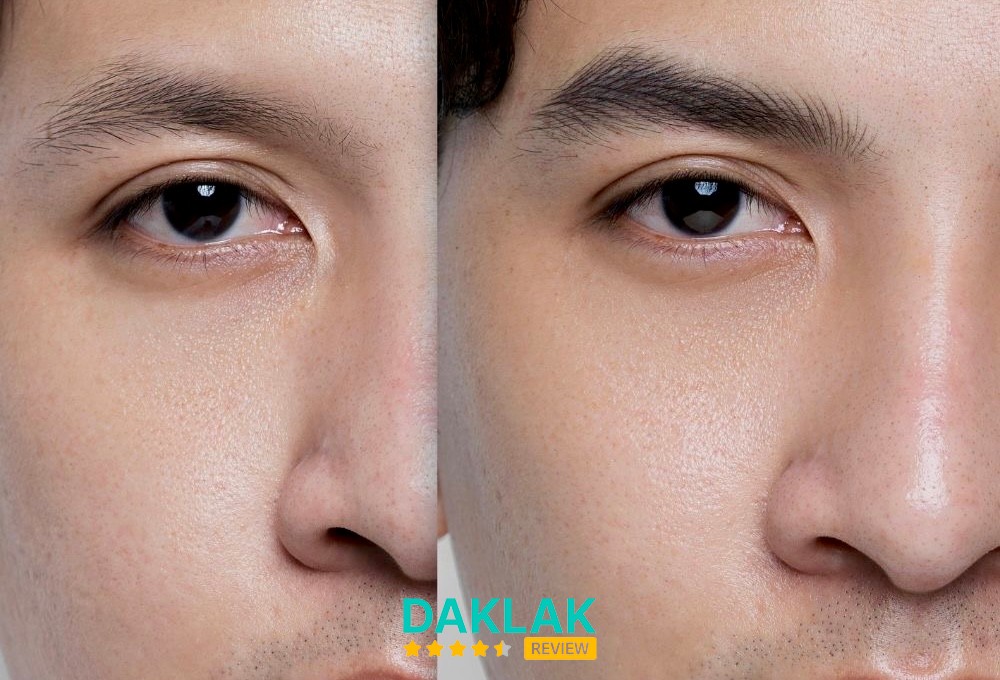 Quỳnh Mai Beauty- Phun Xăm Thành Nhất - phun xăm thẩm mỹ Thành Nhất