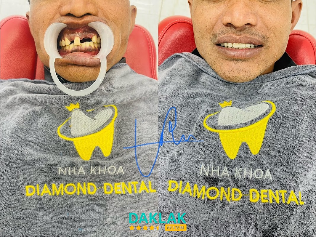 Nha Khoa Diamond Kim Cương II Krông Pắc