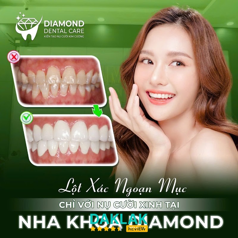 Nha Khoa Diamond Kim Cương II – hình ảnh 3