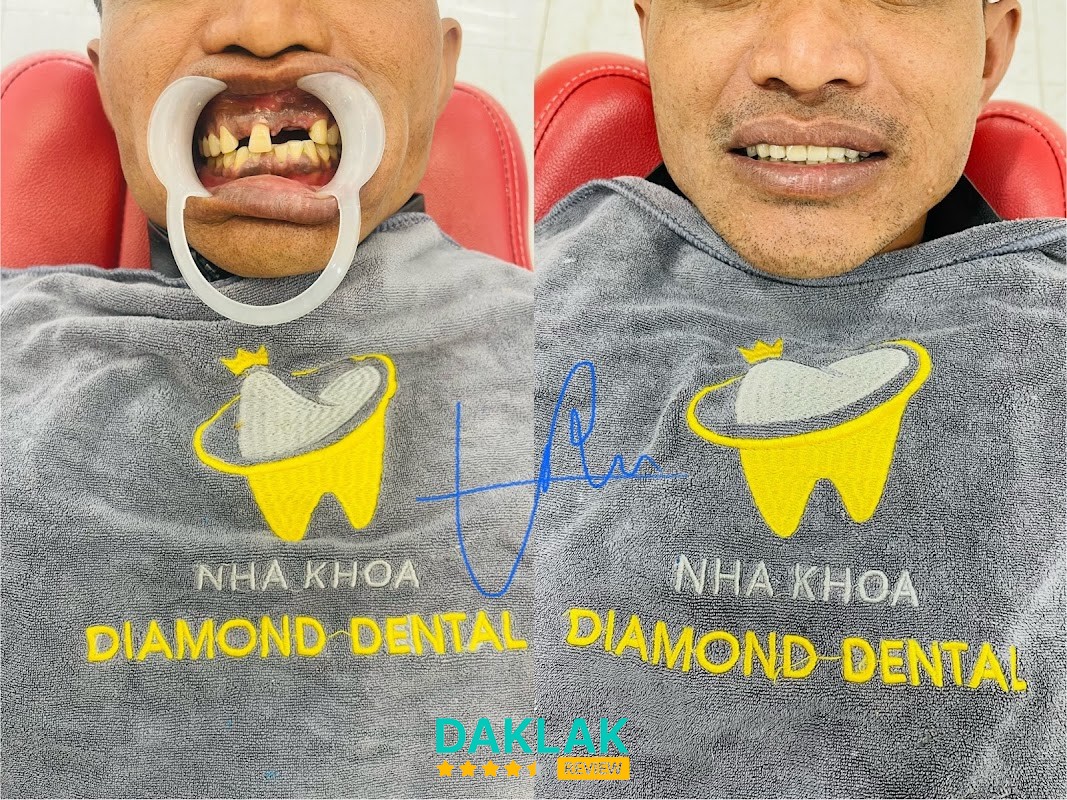 Nha Khoa Diamond Kim Cương II Krông Pắc
