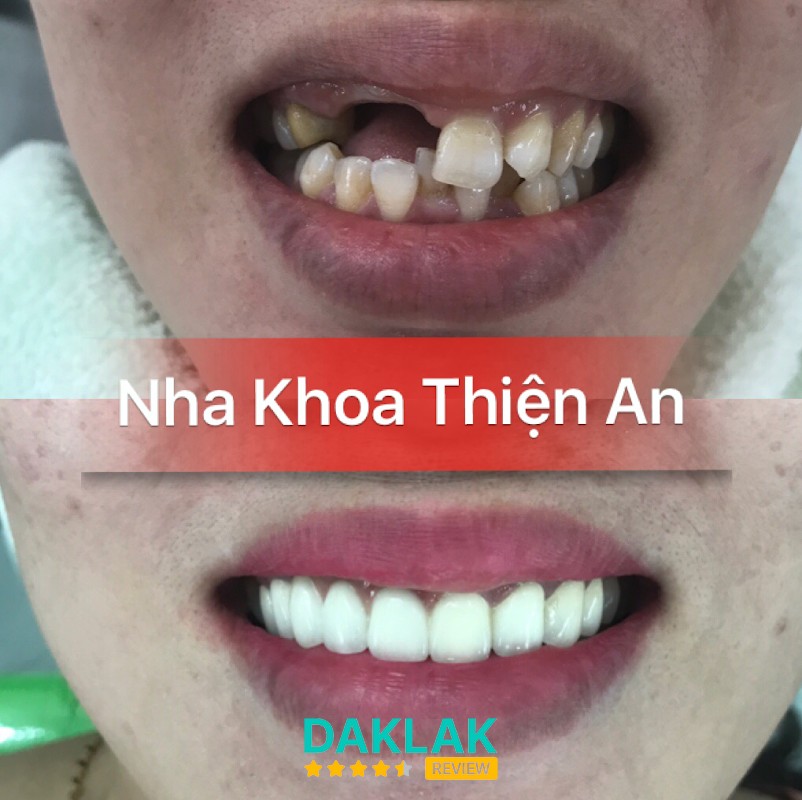 Không gian Nha Khoa Thiện An Tân Lập