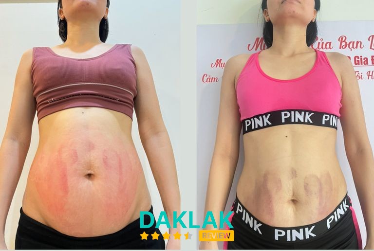 Hình ảnh thứ ba thuộc hồ sơ Yoga Thiên Dung
